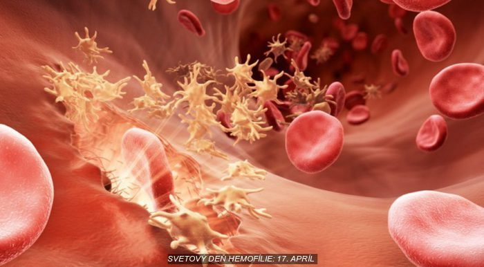 Svetový deň hemofílie