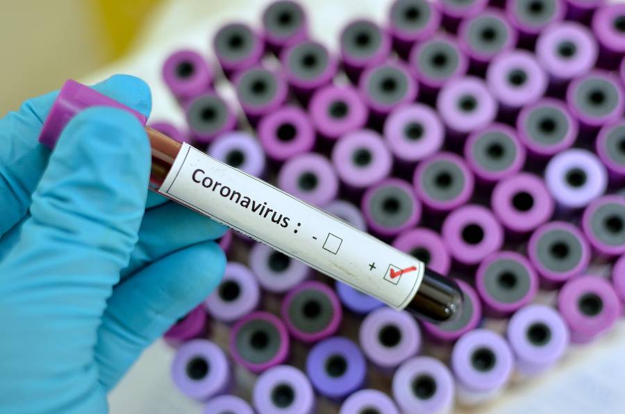 koronavirus-photography-nakaza-ilustracne-virus-epidemia-laboratory-virus-coronavirus-2015-cold-and-flu-micro-organism.jpg