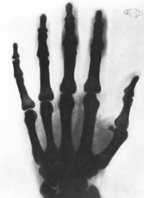 x-ray-of-a-hand-taken-by-nikola-tesla.jpg