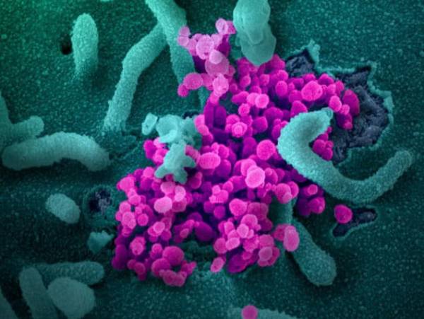 Koronavírus (ružový) pod elektrónovým mikroskopom